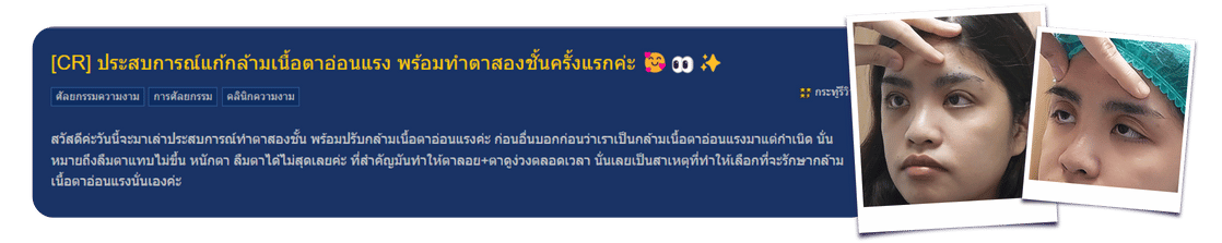 รีวิวตา2ชั้น goodwill clinic pantip by คุณพีช