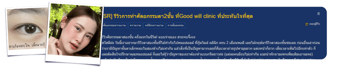 รีวิวตาสองชั้น goodwill clinic pantip by คุณบีม