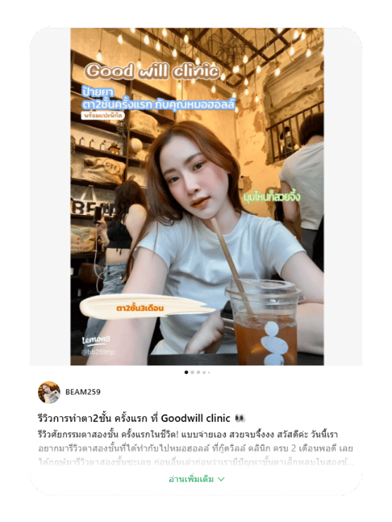 รีวิวตาสองชั้น คุณบีม