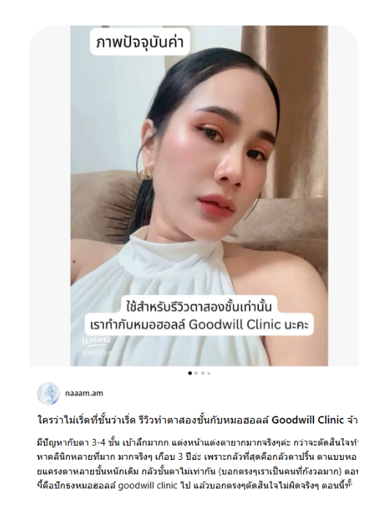 รีวิวทำตาสองชั้นกับหมอฮอลล์ เริ่ดสุด