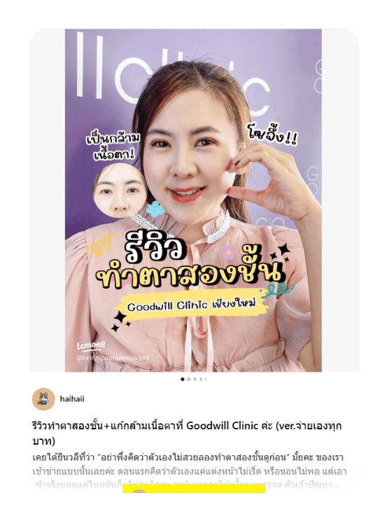 รีวิวแก้กล้ามเนื้อตาอ่อนแรง ที่ Goodwill clinic สาขาเชียงใหม่