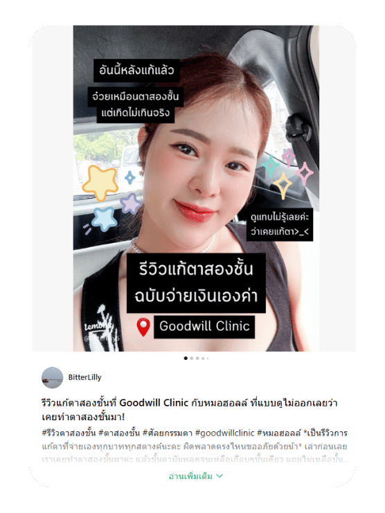 รีวิวแก้ชั้นตาสองชั้น ที่ทำเนียนจนนึกว่าไม่ได้ทำ สวยจึ้ง