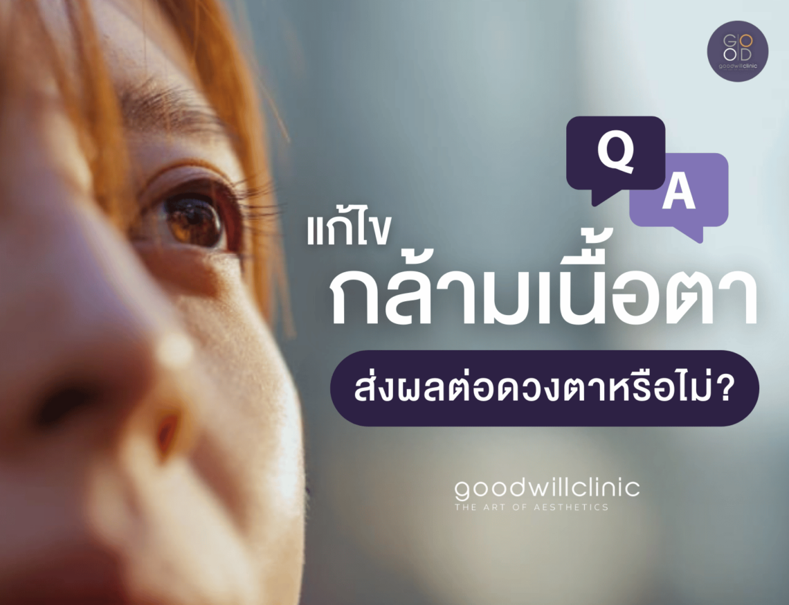 แก้ไขกล้ามเนื้อตา ส่งผลต่อดวงตาหรือไม่ ปก
