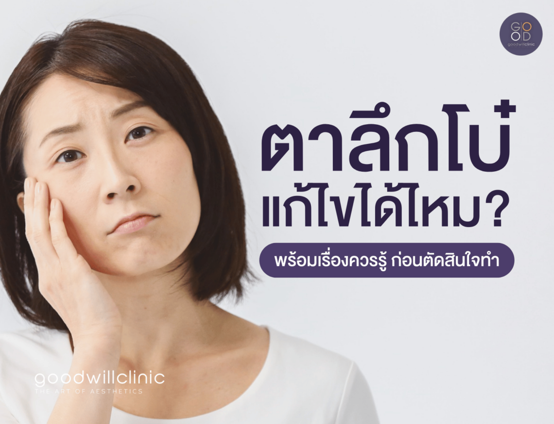 ทำตาสองชั้น แก้ไขตาลึกโบ๋ ทำได้ไหม ปก