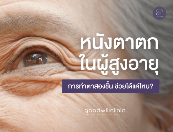 หนังตาตก ในผู้สูงอายุ การทำตาสองชั้นช่วยได้แค่ไหน ปก