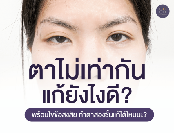 ตาไม่เท่ากัน แก้ยังไงดี ปก