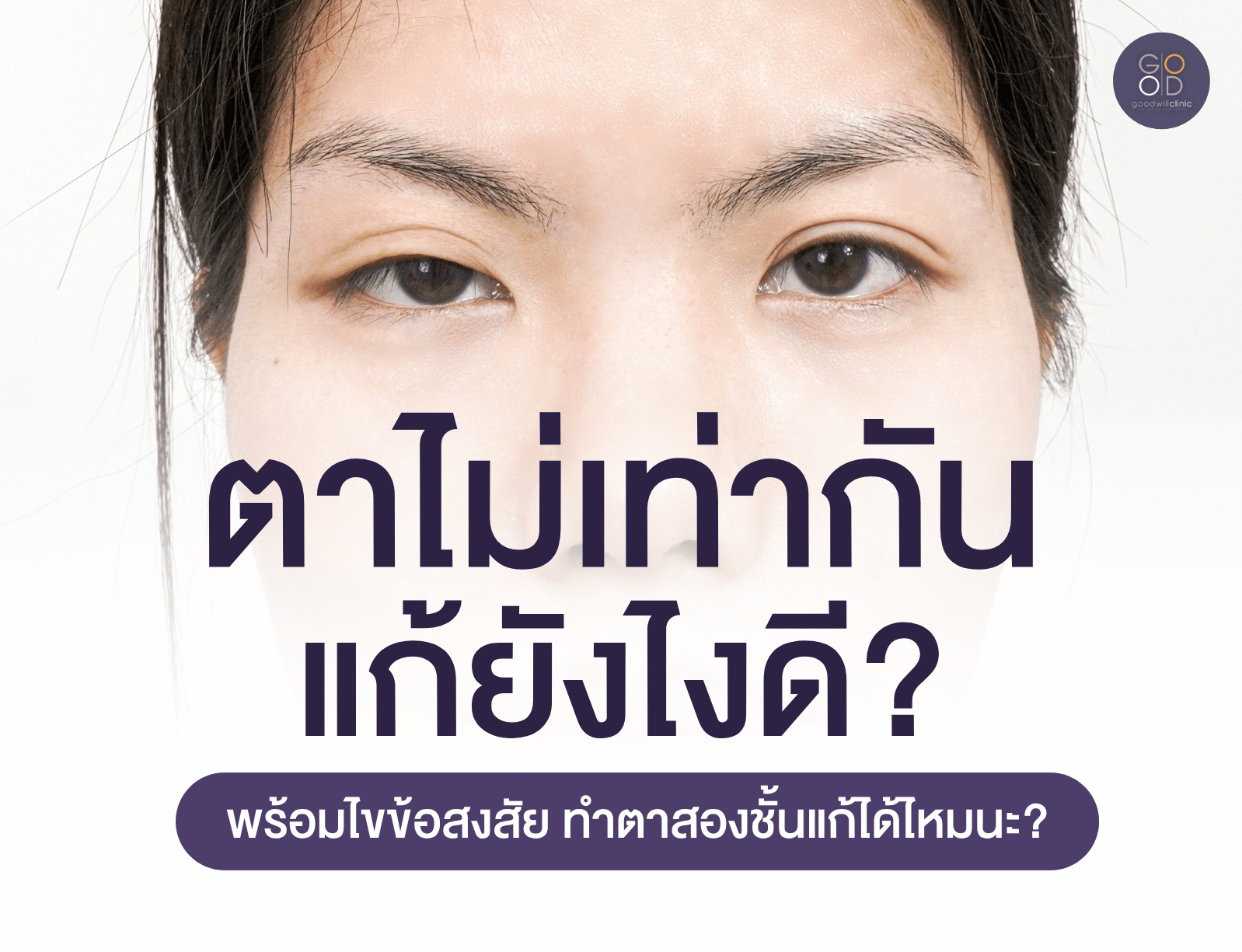 ตาไม่เท่ากัน แก้ยังไงดี ปก