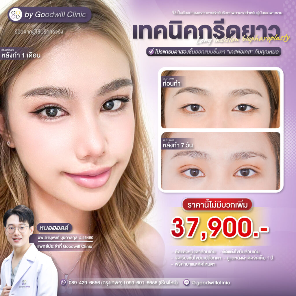 ทำตาสองชั้นราคาเท่าไหร่1