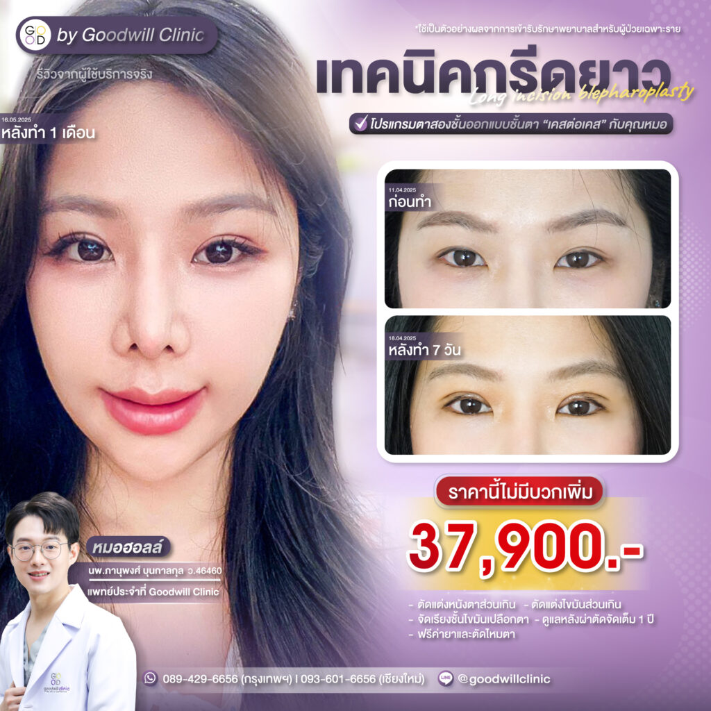 ทำตาสองชั้นราคาเท่าไหร่2