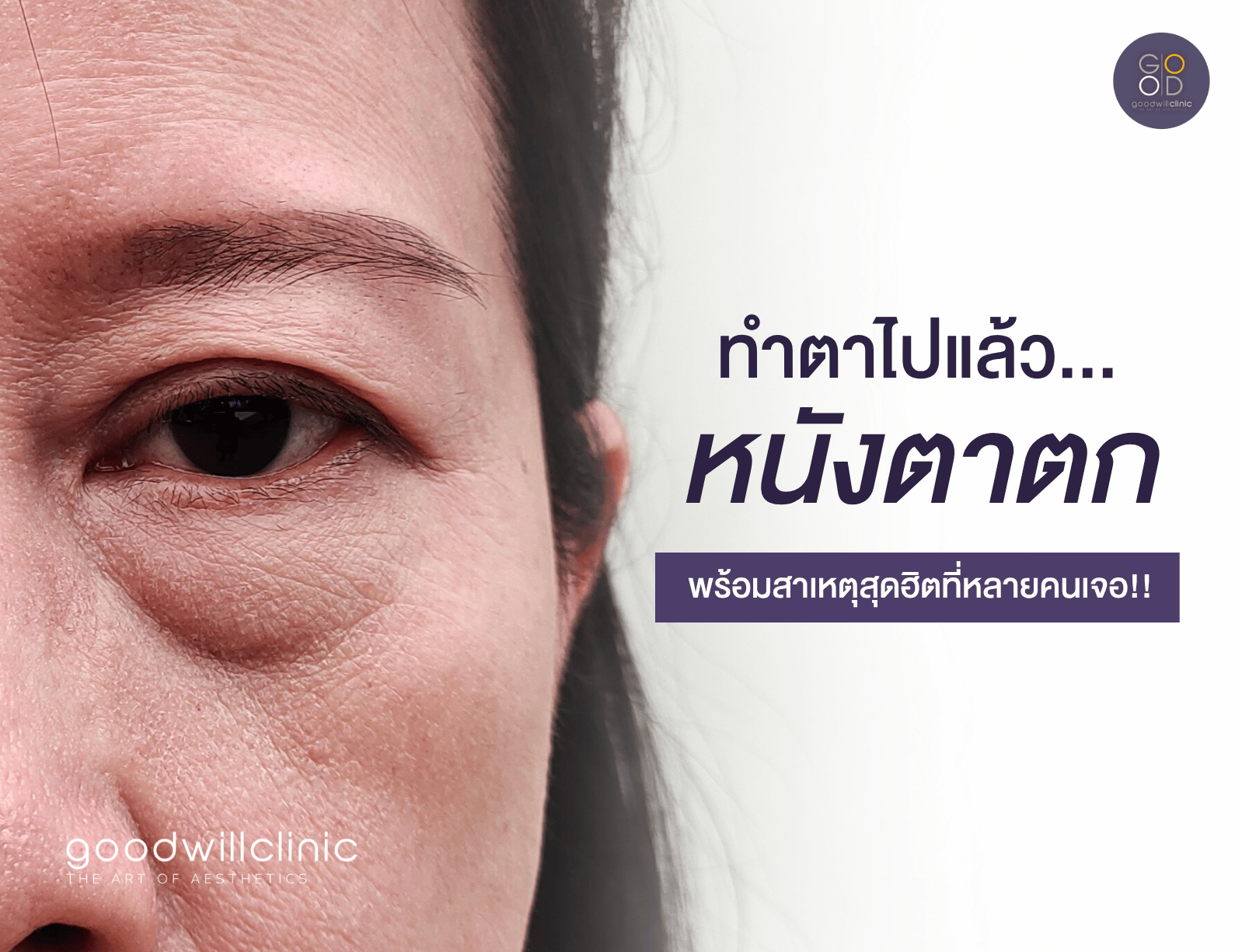 ทำตาสองชั้นไปแล้ว แต่หนังตายังตก ปก