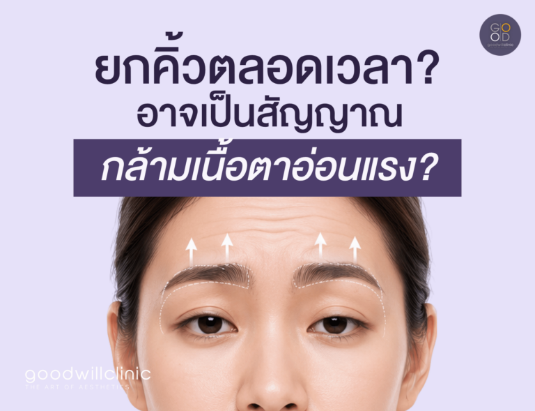 ทำไมยกคิ้วตลอดเวลา ปก