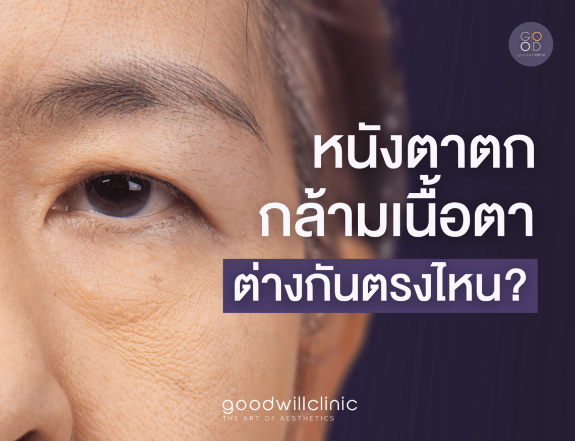 หนังตาตก vs กล้ามเนื้อตา ต่างกันตรงไหน ปก