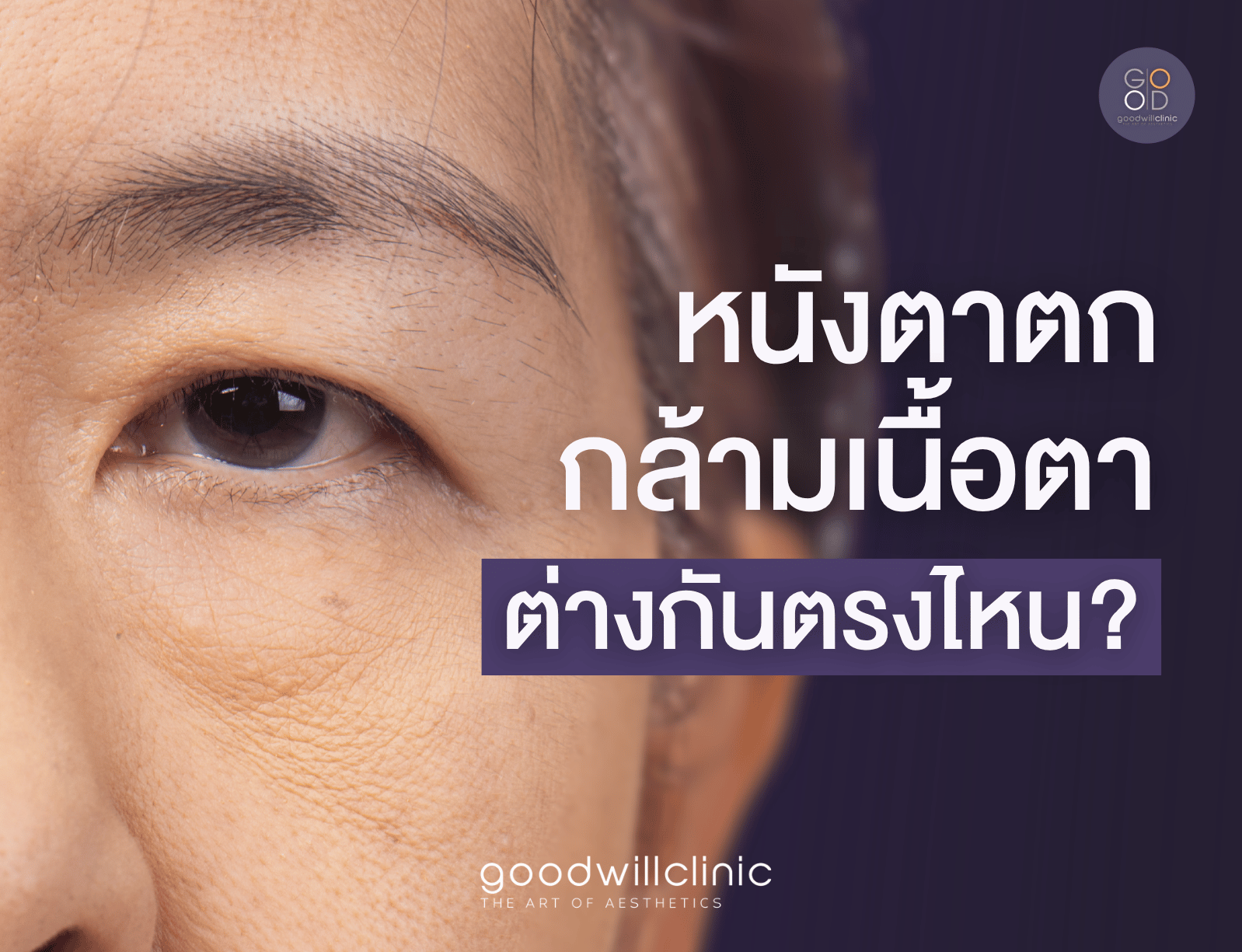 หนังตาตก vs กล้ามเนื้อตา ต่างกันตรงไหน ปก