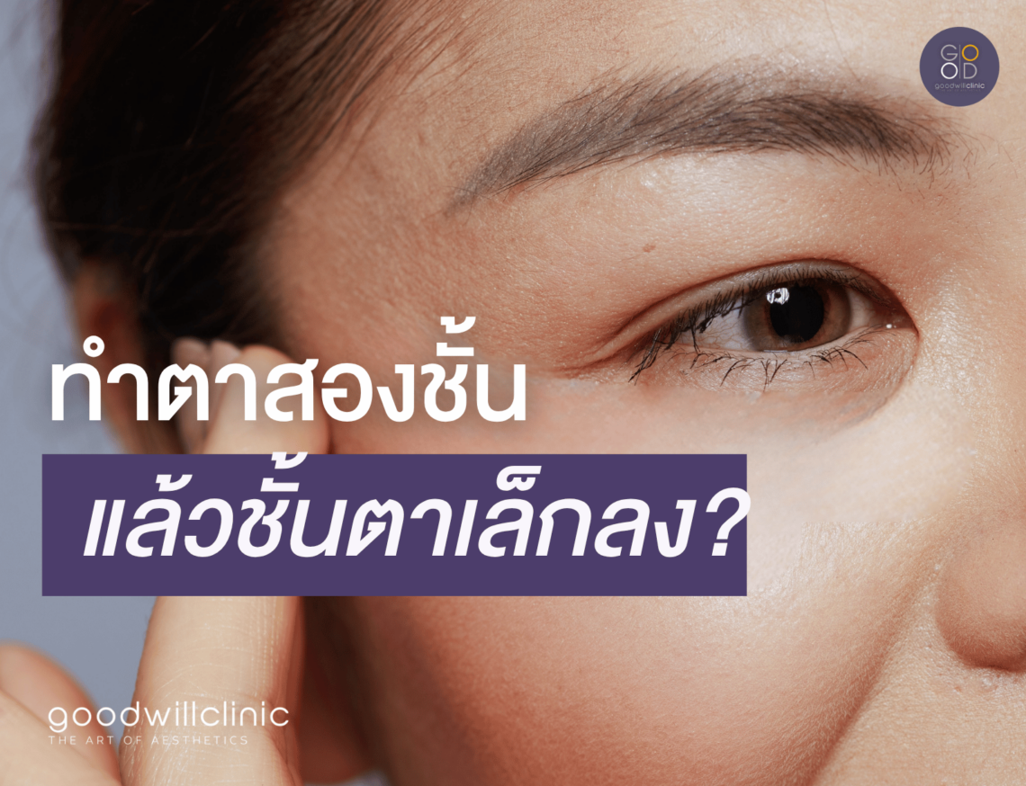 ทำตาสองชั้น แล้วชั้นตาเล็กลง ปก