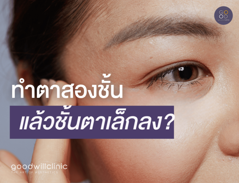 ทำตาสองชั้น แล้วชั้นตาเล็กลง ปก
