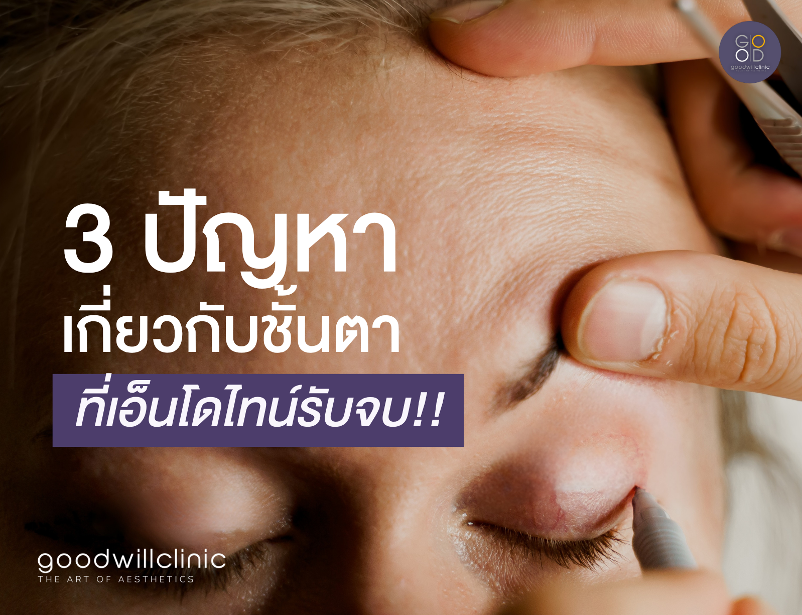 3 ปัญหาชั้นตาแบบไหน ที่เอ็นโดไทน์รับจบ cover