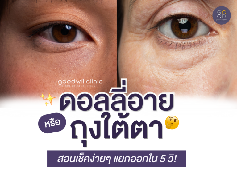 Dolly Eyes vs ถุงใต้ตา ต่างกันตรงไหน ส่องวิธีแยกให้ออกใน 5 วินาที! ปก