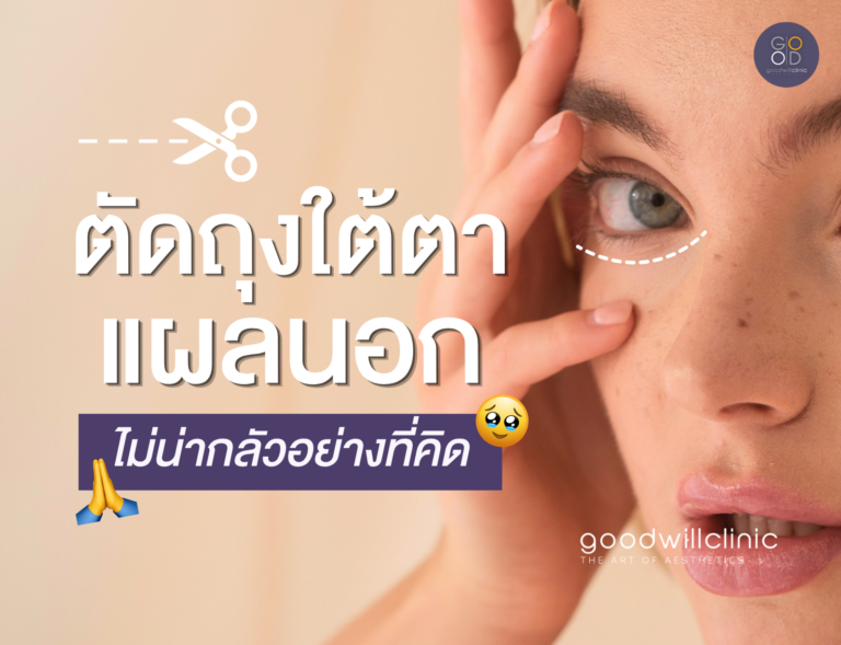 ตัดถุงใต้ตาแผลนอก ไม่น่ากลัวอย่างที่คิด ปก