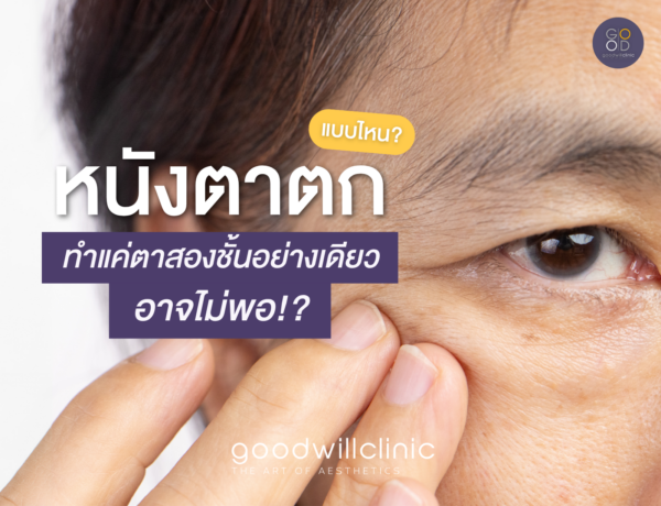 หนังตาตกแบบไหน ทำตาสองชั้นอย่างเดียวอาจไม่พอ ปก